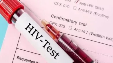 تعداد بیماران مبتلا به ایدز در کشور اعلام شد ؛ تفاوت قابل توجه تعداد مردان و زنان مبتلا به HIV (اچآیوی) تعداد بیماران مبتلا به ایدز در کشور اعلام شد ؛ تفاوت قابل توجه تعداد مردان و زنان مبتلا به HIV (اچآیوی)