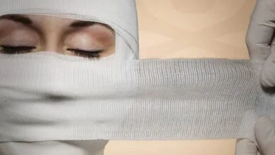 اسیدپاشی به صورت زن جوان توسط همسرش | هدفم او نبود ، اشتباه شد!