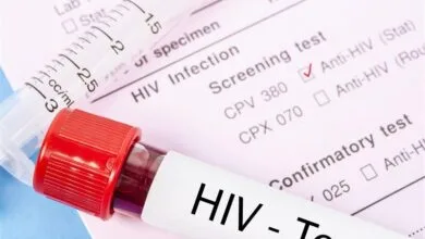 این افراد حتما برای انجام تست HIV مراجعه کنند | برای تست به کدام آزمایشگاه‌ها برویم؟