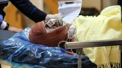 لزوم تشکیل صندوق ویژه حوادث سوختگی در کشور/ کمبود ۱۲۰۰ تخت سوختگی در کشور لزوم تشکیل صندوق ویژه حوادث سوختگی در کشور/ کمبود ۱۲۰۰ تخت سوختگی در کشور