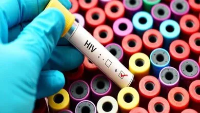 مشاوره، جزو لاینفک تست HIV / نتایج پویش اخیر وزارت بهداشت