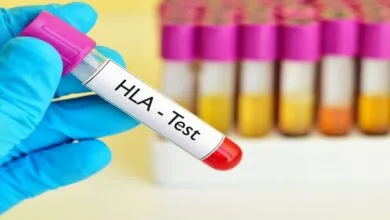 ضرورت توجه به قومیت‌ها برای تقویت بانک اطلاعاتی HLA جهت پیوند سلول‌های بنیادی