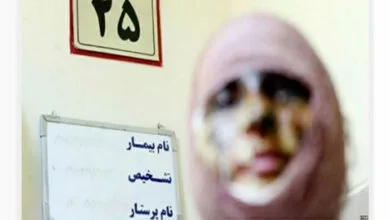 اسیدپاشی مرد شکاک به همسرش و همکار او در تهران