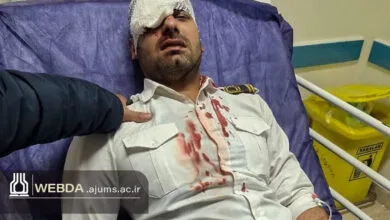 نابینا شدن چشم پرسنل بیمارستان مسجدسلیمان در پی حمله همراه بیمار نابینا شدن چشم پرسنل بیمارستان مسجدسلیمان در پی حمله همراه بیمار