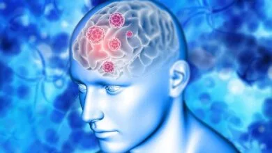 چرا جوانان دچار خونریزی مغزی میشوند؟