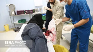 انفجار نارنجک در دست مرد ٣٠ ساله انفجار نارنجک در دست مرد ٣٠ ساله