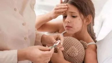آبله مرغان برای چه افرادی خطرناک است؟